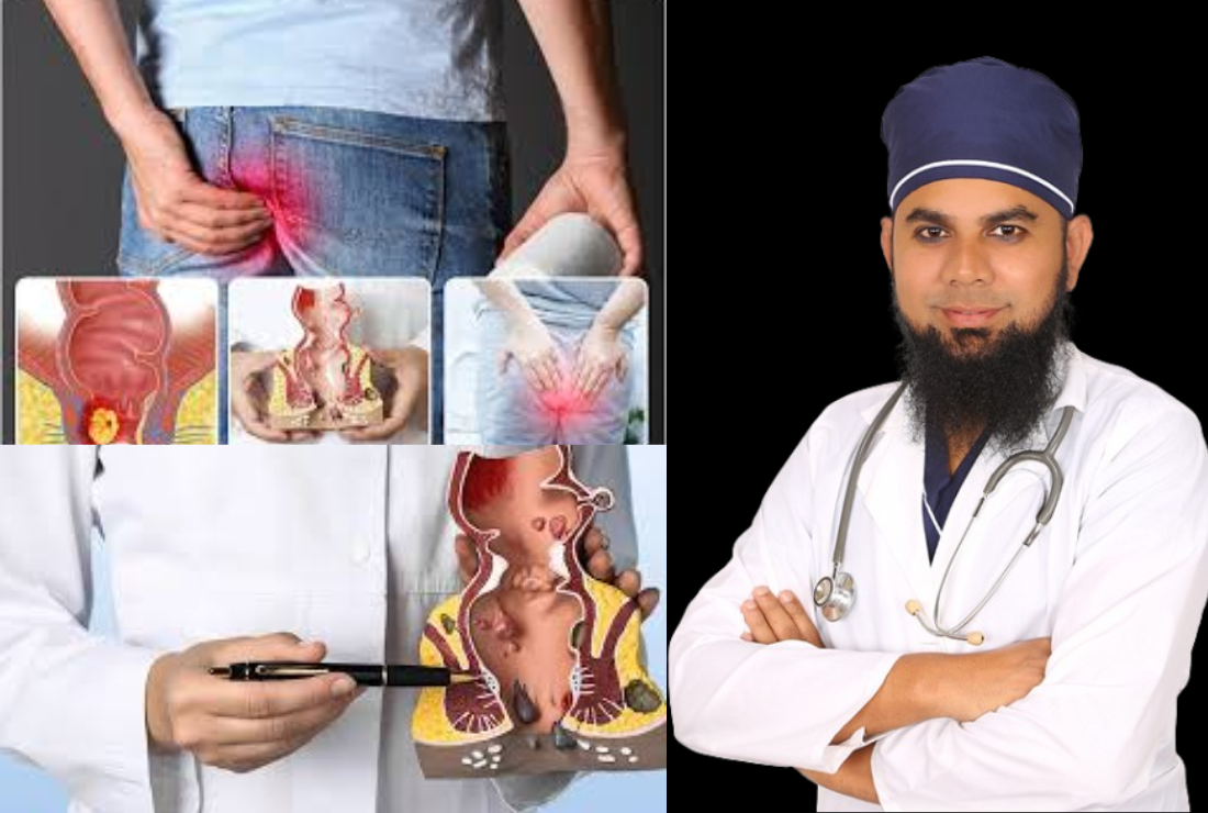 piles treatment BD
